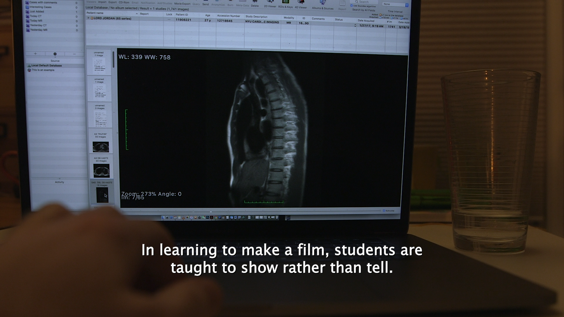 Image description: The inside of a body, including a spine and other organs, appears on a laptop screen. A white person's hand reaches toward the laptop's keyboard. On top of the hand, a caption reads: “In learning to make a film, students are taught to show rather than tell.”